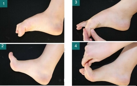 Косточка с больших пальцев стоп уходит. 5 упражнений, которые я делала